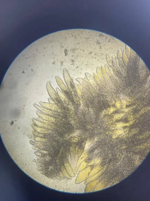 Microscope view of an abnormal shrimp hepatopancreas