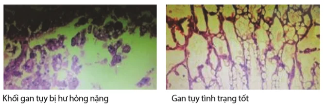 Hepatopancreas histology: left, a badly damaged hepatopancreas; right, a hepatopancreas in good condition
