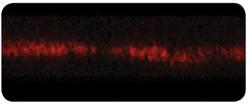 Microscope image of infected gut lining with BIO MAX: red band continuous again