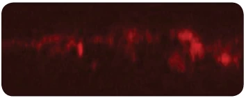 Microscope image of infected gut lining: broken, patchy red band