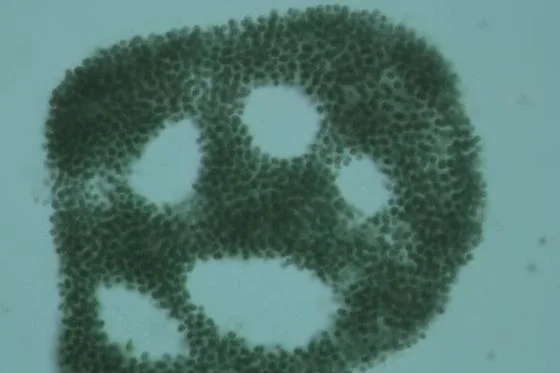 Before · blue-green algae (Microcystis)