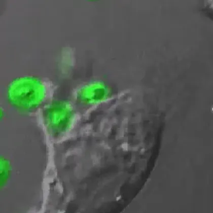 A shrimp blood cell approaching green fluorescent pathogen particles