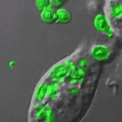 The blood cell engulfing the pathogen particles completely